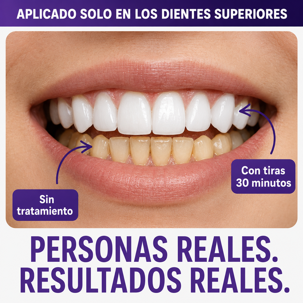 Luma White™ | Tiras Blanqueadoras ORIGINALES | Sonrisa Blanca Instantánea