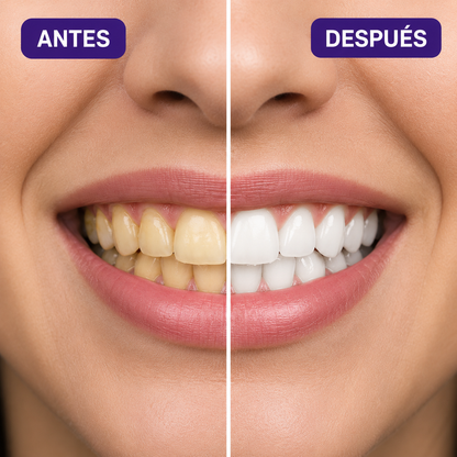 Luma White™ | Tiras Blanqueadoras ORIGINALES | Sonrisa Blanca Instantánea